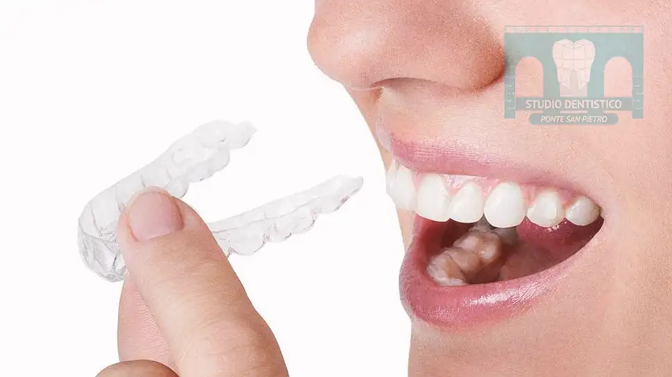 gnatologia bergamo bite malocclusione bruxismo studio dentistico ponte san pietro